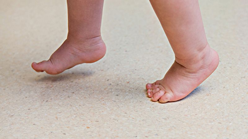 Trẻ đi nhón chân có phải bệnh lý nguy hiểm?