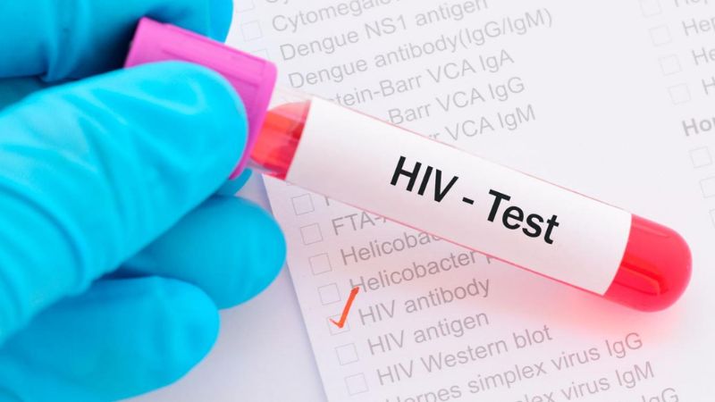 Dấu hiệu nhiễm HIV ở nam giới theo từng giai đoạn mà bạn nên biết