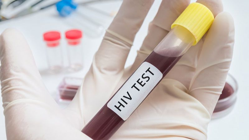 Dấu hiệu HIV ở nam giới giai đoạn 2: Giai đoạn không triệu chứng