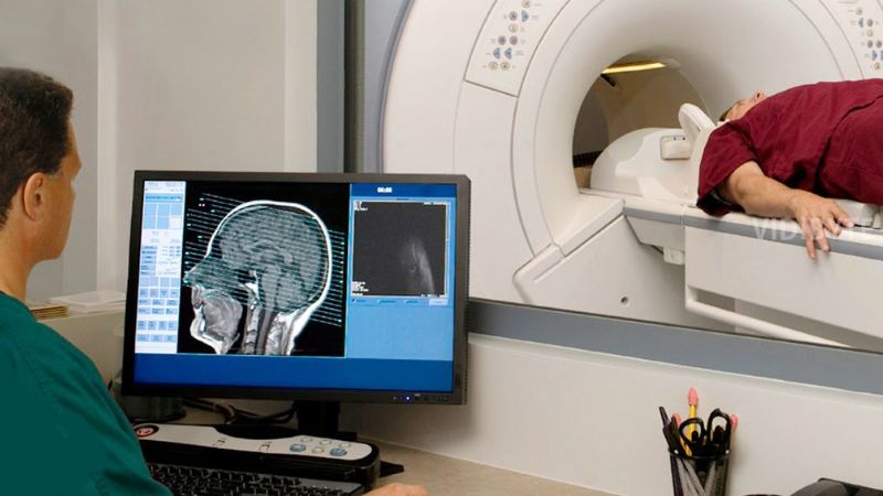 Ưu điểm khi chụp cộng hưởng từ MRI
