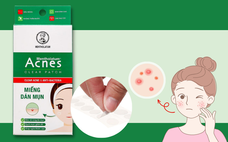 Acnes Clear Patch acne healing patch