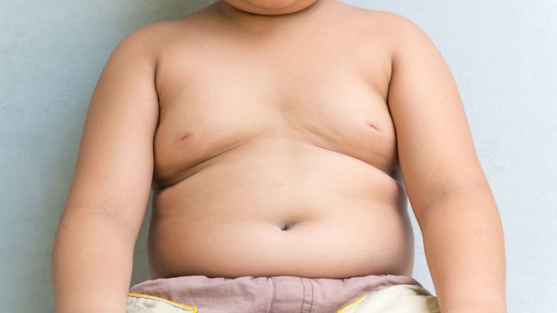 Cách xác định bệnh béo phì ở trẻ em, trẻ béo phì dễ gây ra những bệnh gì?