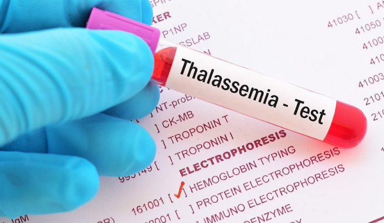 Bệnh Thalassemia - thiếu máu nhưng thừa sắt ở trẻ có nguy hiểm không?