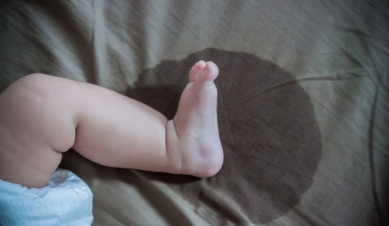 Nguyên nhân chính và cách điều trị hiện tượng đái dầm ở trẻ