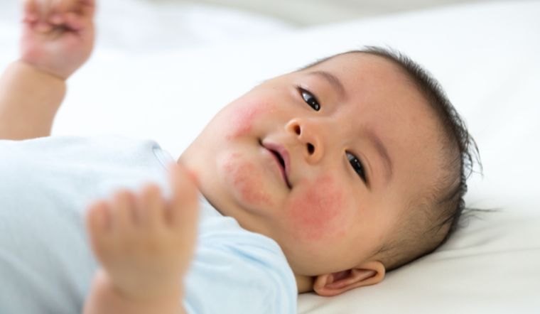 Ba, mẹ có nên giải độc gan định kỳ cho trẻ không?