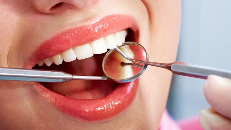 5 lời khuyên hữu ích của bác sĩ chỉnh nha để niềng răng thành công
