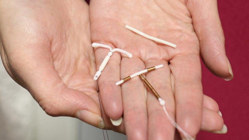 What is an IUD? Is the IUD safe?