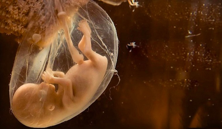 Nước ối đục có nguy hiểm không?