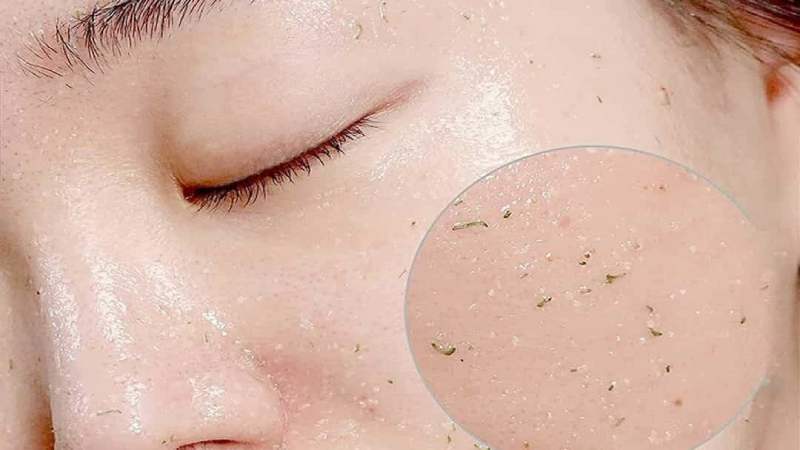 Học ngay các bước skincare cơ bản trong mùa hè để da mặt luôn xinh