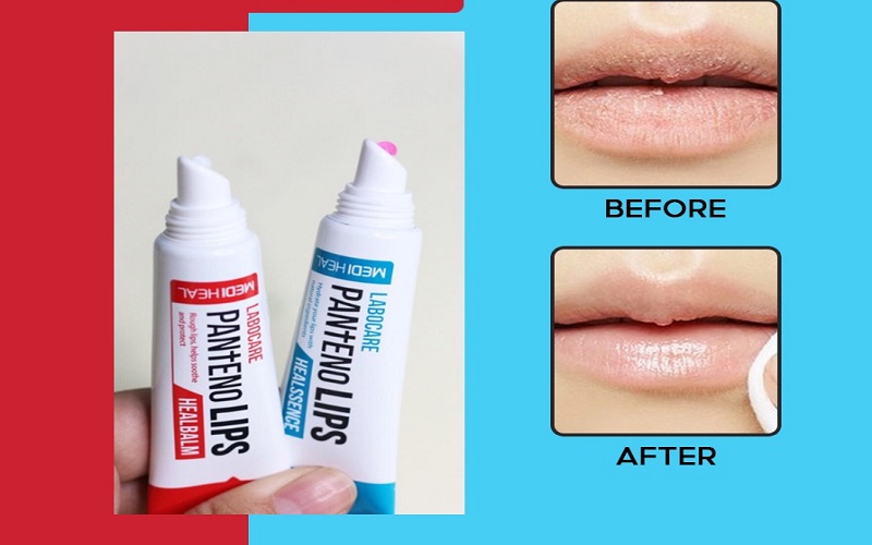 Công dụng son dưỡng môi Mediheal