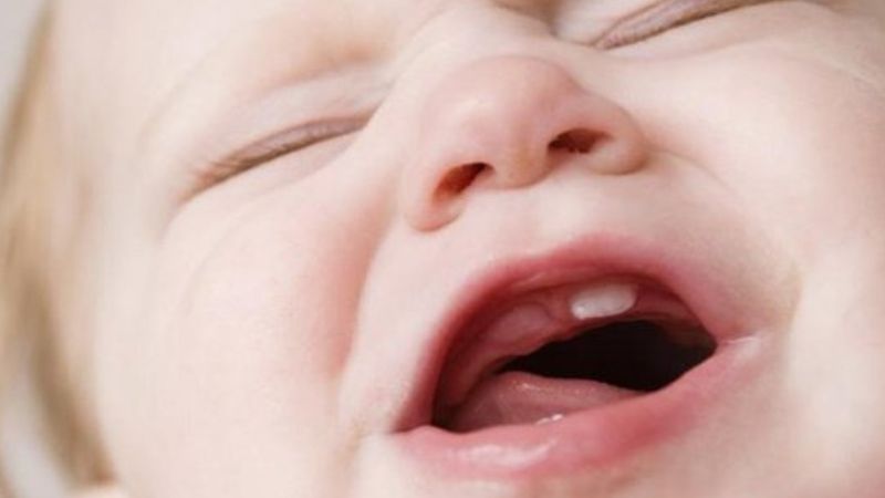Do bé đang mọc răng Do bé đang mọc răng