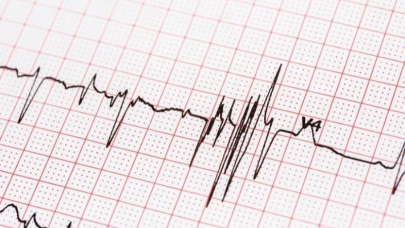 Đo điện tĐo điện tâm đồ (ECG) khi kiểm tra sức khỏe ở người cao tuổiâm đồ (ECG) khi kiểm tra sức khỏe ở người cao tuổi