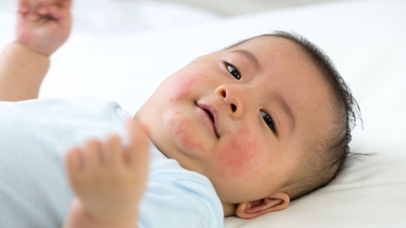 Sữa từ mẹ khác có thể gây dị ứng