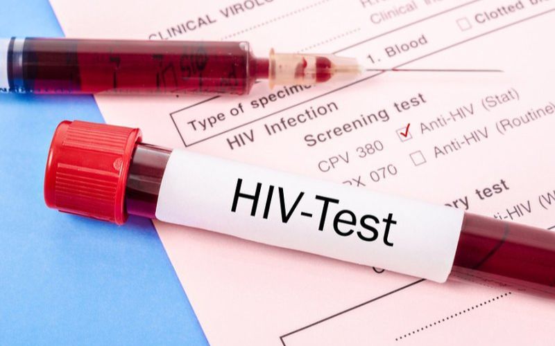 Xét nghiệm HIV và STD