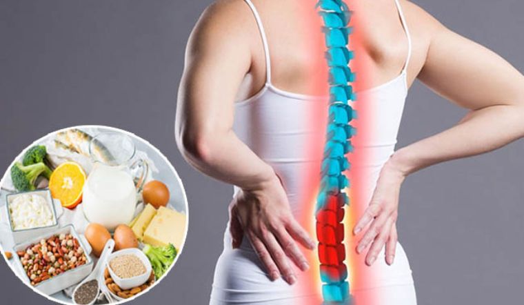 Đau thần kinh tọa kiêng ăn gì, kiêng gì để giảm đau?
