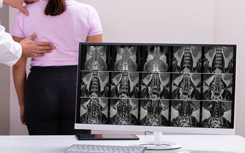 Những tác hại của gù lưng