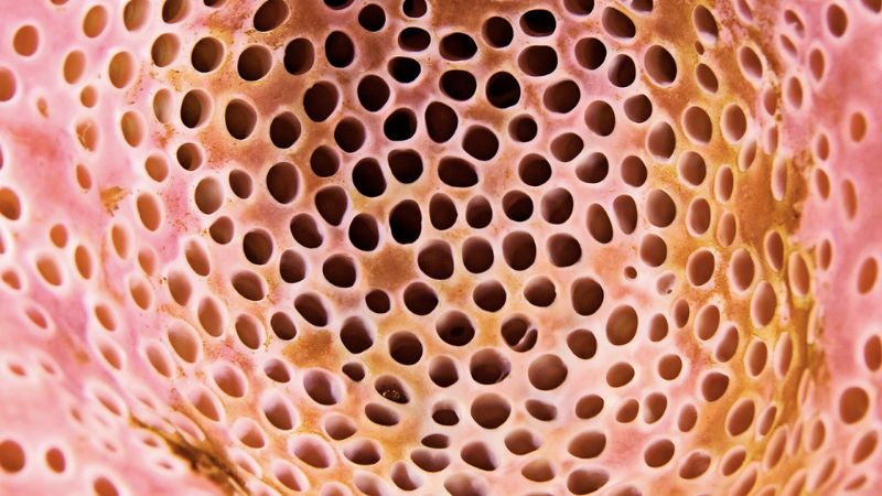 Hội chứng sợ lỗ (Trypophobia)