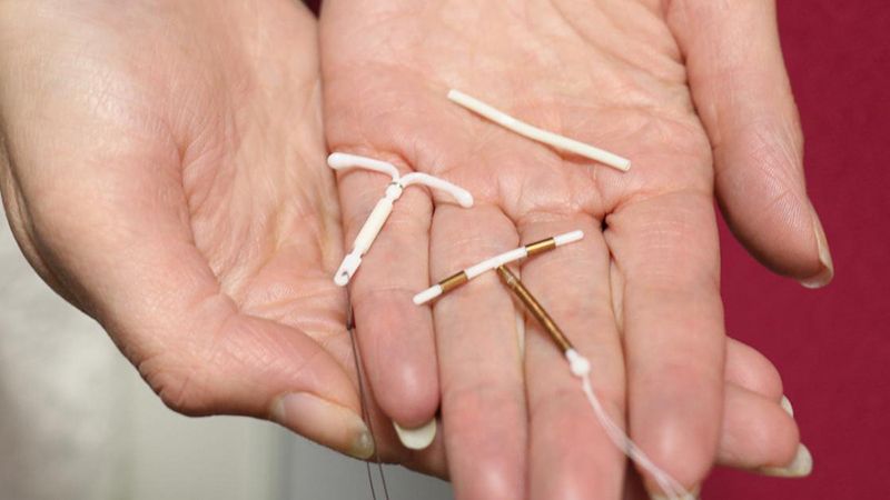 Contraception with the use of intrauterine devices (IUDs)