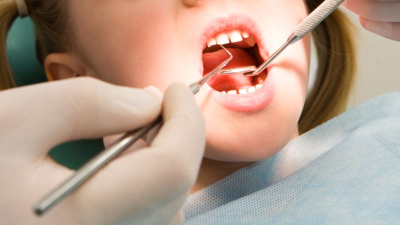 Cách phòng ngừa sâu răng do bú bình ở trẻ