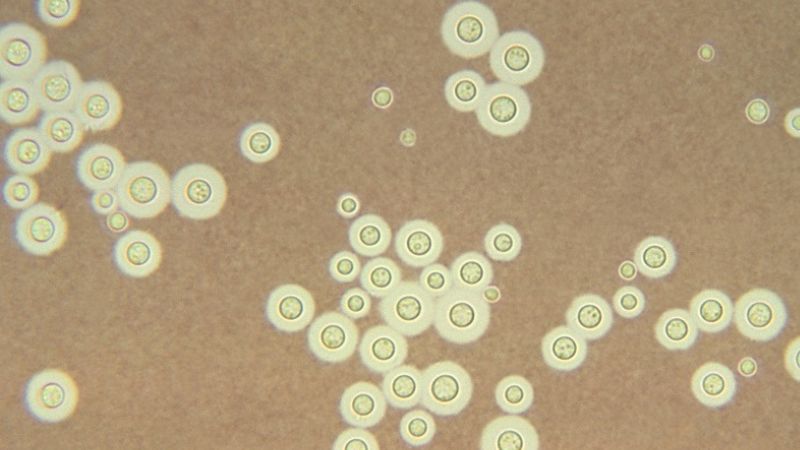 Cryptococcus neoformans