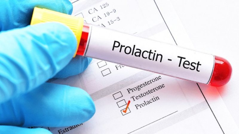 Prolactin cao có chữa được không?