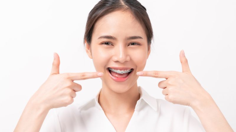 Thời điểm thích hợp cho việc niềng răng nhất là khi còn trẻ, trong khoảng từ 7-9 tuổi