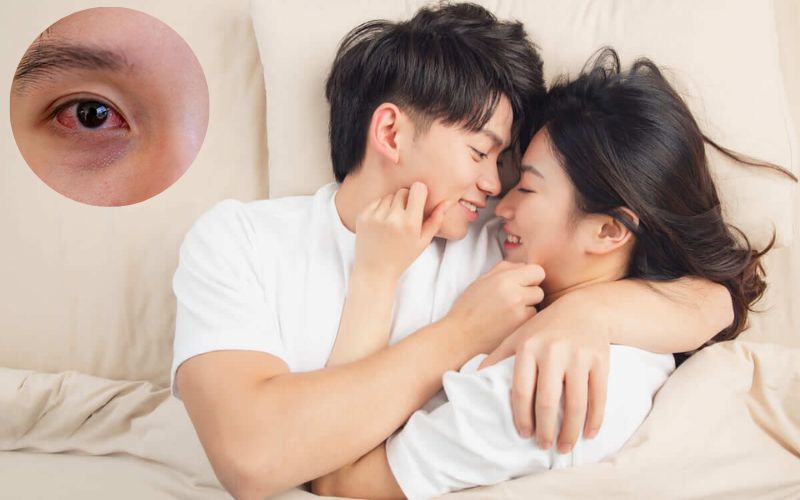 Việc quan hệ tình dục khi bị đau mắt đỏ sẽ khiến tăng cao nguy cơ lây bệnh