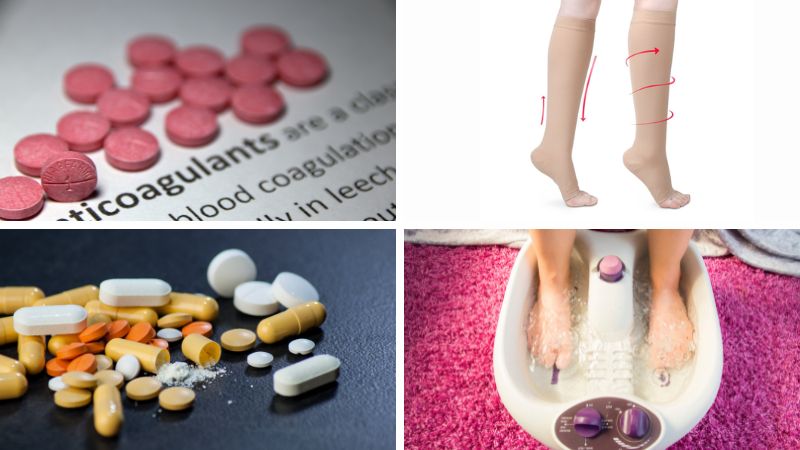 Một số phương pháp điều trị bệnh suy giãn tĩnh mạch ở chân Một số phương pháp điều trị bệnh suy giãn tĩnh mạch ở chân