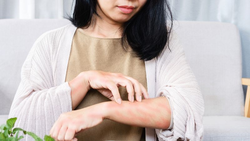Phản ứng toàn thân Phản ứng toàn thân