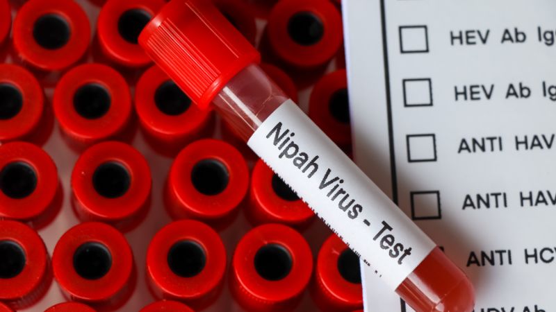 Cách chẩn đoán và điều trị nhiễm virus Nipah hiện nay