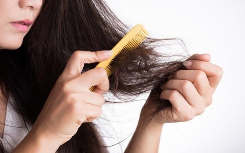 Vì sao bị rụng tóc sau sinh? Sau sinh bao lâu thì được chải tóc?