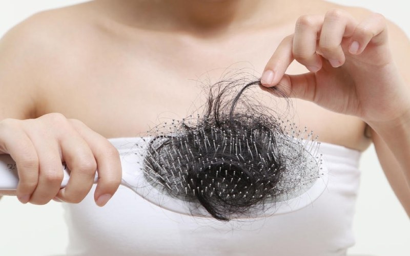 Vì sao bị rụng tóc sau sinh? Sau sinh bao lâu thì được chải tóc?