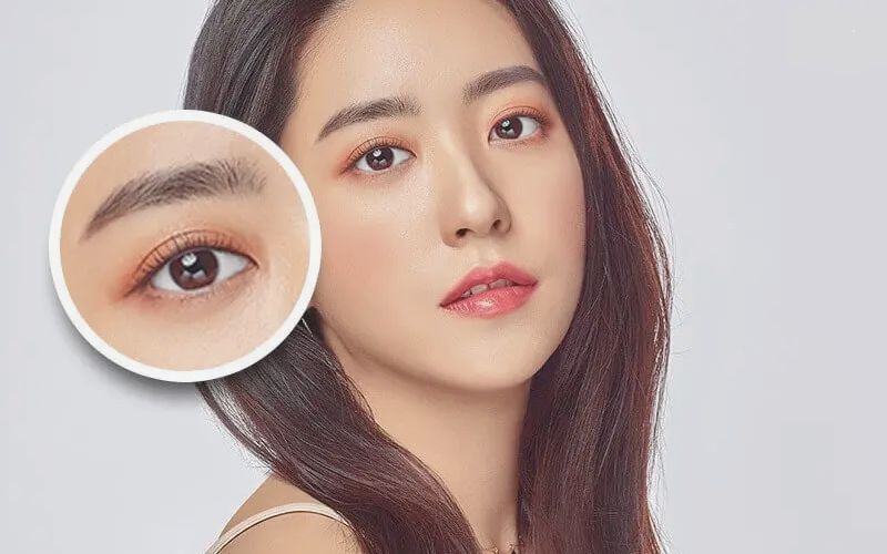Nhấn mí mắt có thể khắc phục mắt mí lót