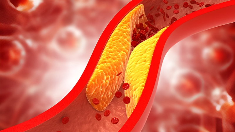Mùa lạnh khiến mức cholesterol "xấu" trong cơ thể tăng cao hơn