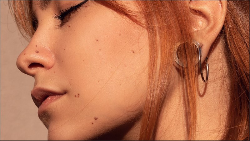 Cách xoá nốt ruồi trong Photoshop