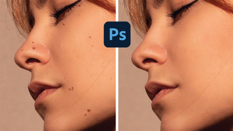 Cách xóa nốt ruồi trong Photoshop