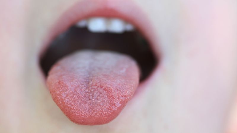 Khi dạ dày yếu, lưỡi thường có màu nhợt nhạt