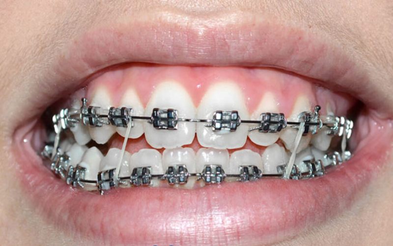 Một số câu hỏi liên quan Một số câu hỏi liên quan