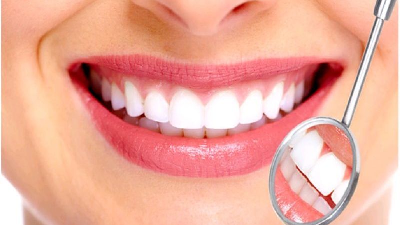 Bọc răng sứ cho 4 răng cửa ở đâu? Giá bao nhiêu?