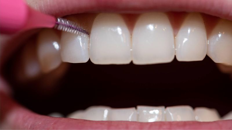 Cách sử dụng bàn chải kẽ răng