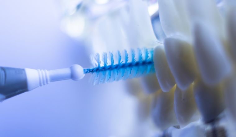 Bàn chải kẽ răng là gì? Cách sử dụng bàn chải kẽ cho người niềng răng