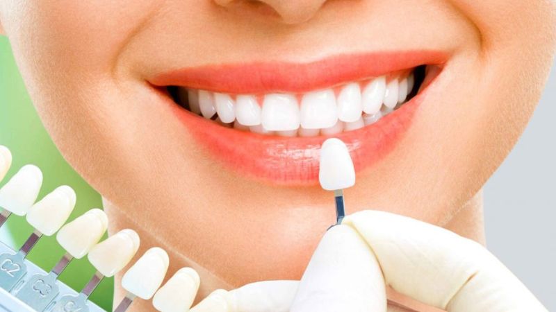 Răng sứ Mỹ có tốt không?