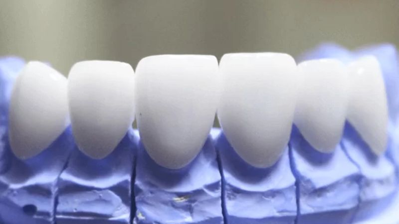 Răng toàn sứ Ceramill Zolid