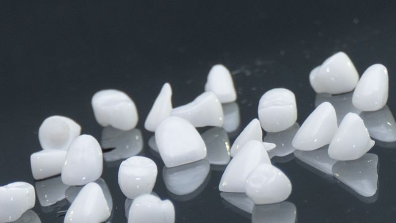 Trồng răng sứ Ceramill ở đâu? Giá bao nhiêu?