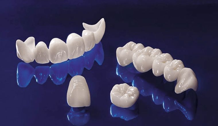 Răng sứ Ceramill là gì? Bọc răng sứ Ceramill có tốt không?