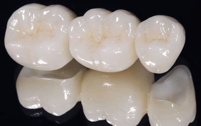 Răng sứ toàn sứ Zirconia