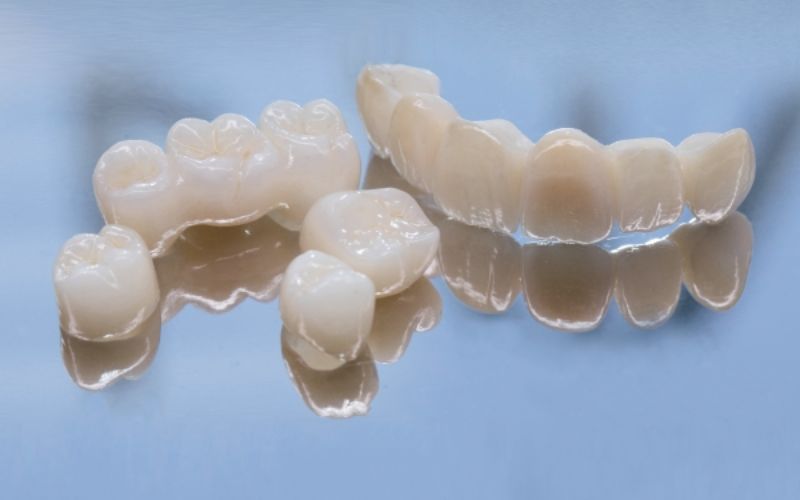 Răng toàn sứ có giá khoảng 3.000.000 - 8.000.000 đồng/ răng