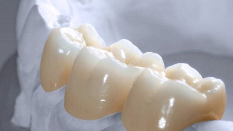 Cách nhận biết răng sứ Zirconia