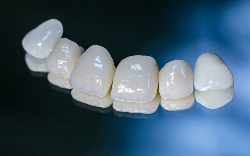 Răng sứ Lava Esthetic Fluorescent Full-Contour Zirconia