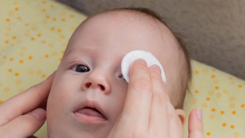 Các bước xử lý khi sữa mẹ dính vào mắt trẻ